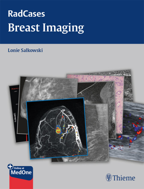 Cover image for book Radcases Breast Imaging