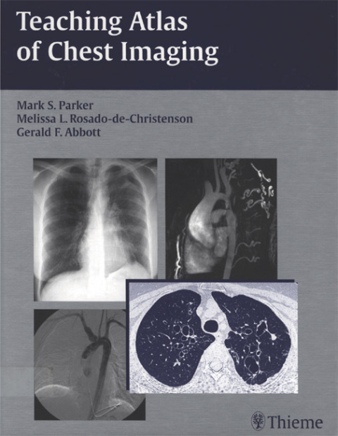 Cover image for book Teaching Atlas of Chest Imaging