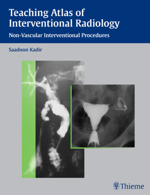 Cover image for book Teaching Atlas of Interventional Radiology
