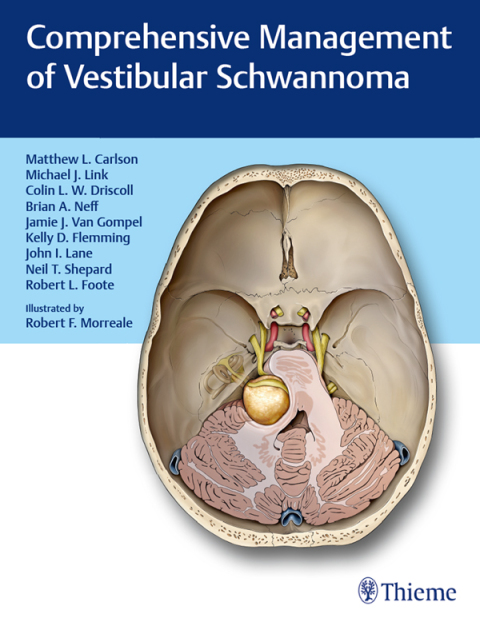 Comprehensive Management of Vestibular Schwannoma 