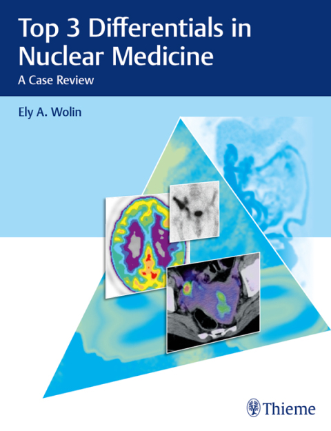 Cover image for book Top 3 Differentials in Nuclear Medicine