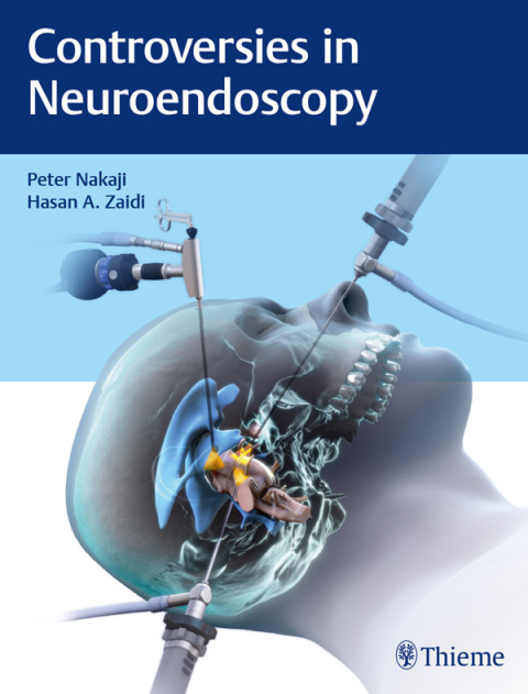 Cover image for book Controversies in Neuroendoscopy