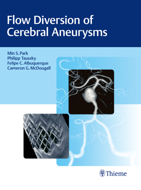 Cover image for book Flow Diversion of Cerebral Aneurysms