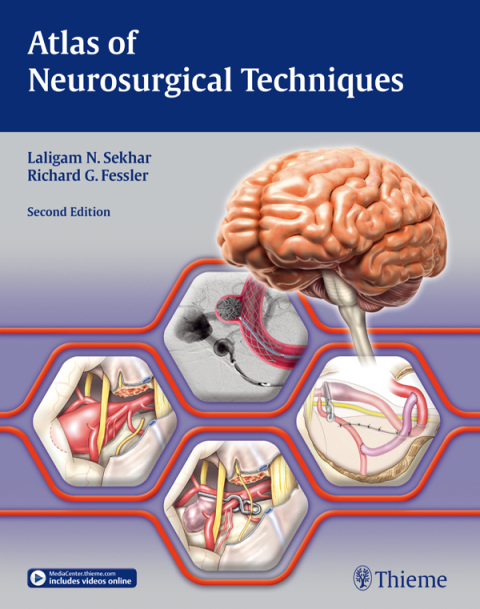 Cover image for book Atlas of Neurosurgical Techniques