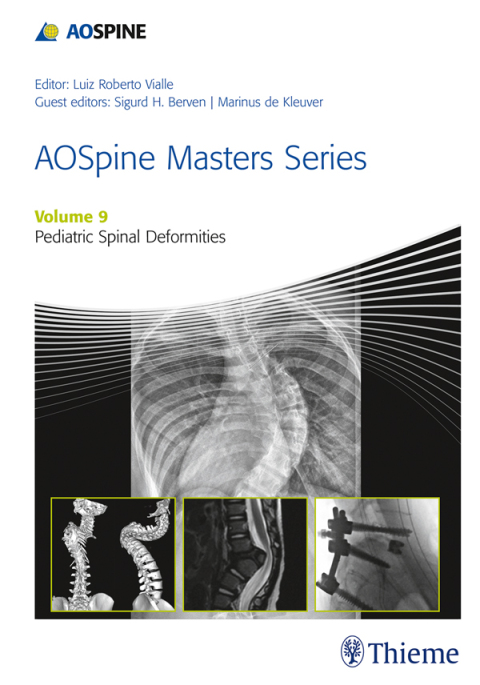 Cover image for book AOSpine Masters Series, Volume 9: Pediatric Spinal Deformities