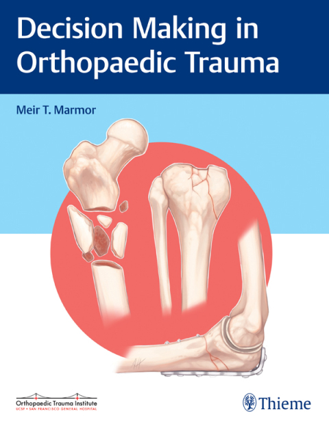 Cover image for book Decision Making in Orthopaedic Trauma