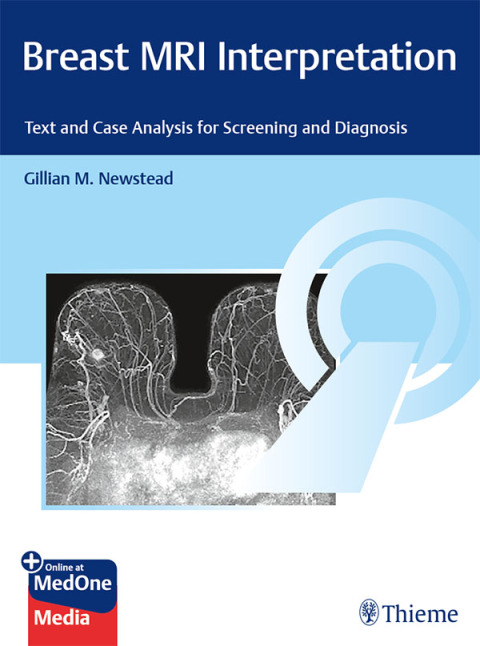 Cover image for book Breast MRI Interpretation