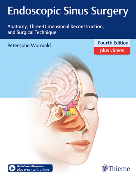 Cover image for book Endoscopic Sinus Surgery
