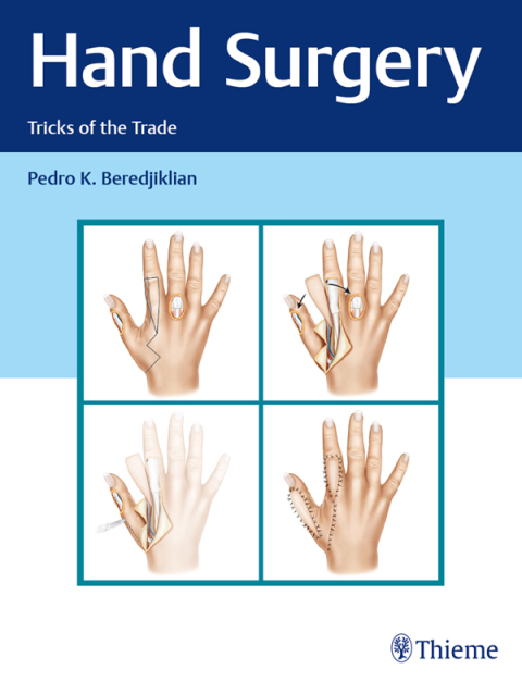 Cover image for book Hand Surgery