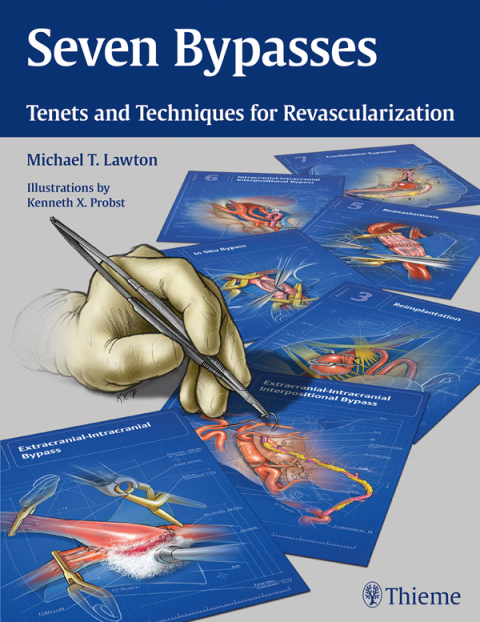 Cover image for book Seven Bypasses