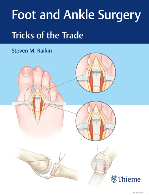 Cover image for book Foot and Ankle Surgery