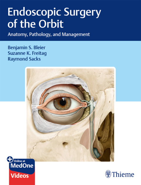 Cover image for book Endoscopic Surgery of the Orbit