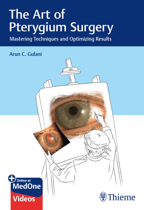 Cover image for book The Art of Pterygium Surgery
