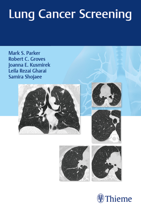 Cover image for book Lung Cancer Screening