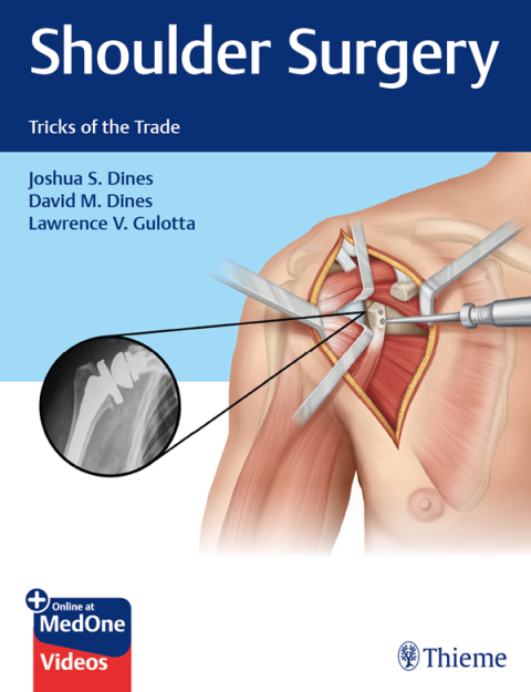 Shoulder Surgery 