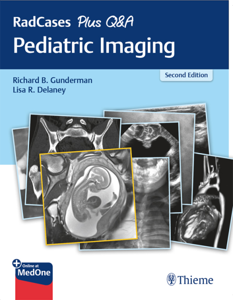Cover image for book RadCases Plus Q&A Pediatric Imaging