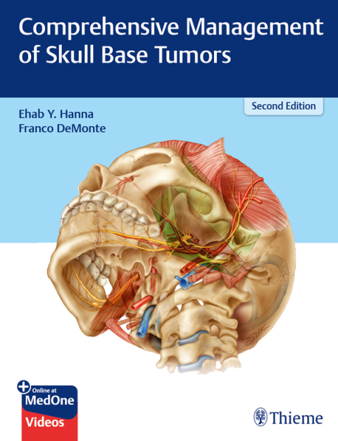 Cover image for book Comprehensive Management of Skull Base Tumors