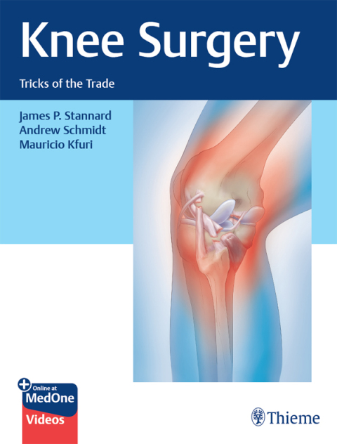 Cover image for book Knee Surgery