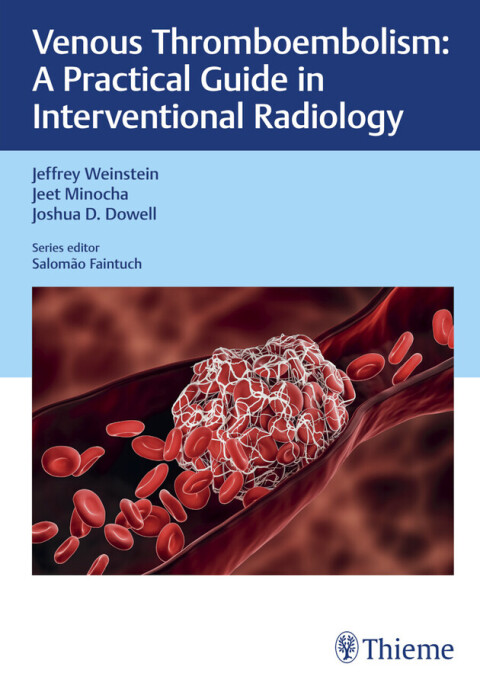 Cover image for book Venous Thromboembolism