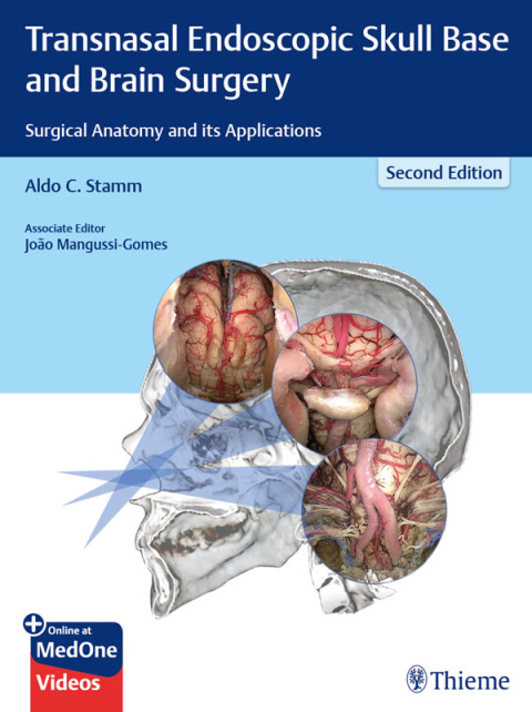 Cover image for book Transnasal Endoscopic Skull Base and Brain Surgery