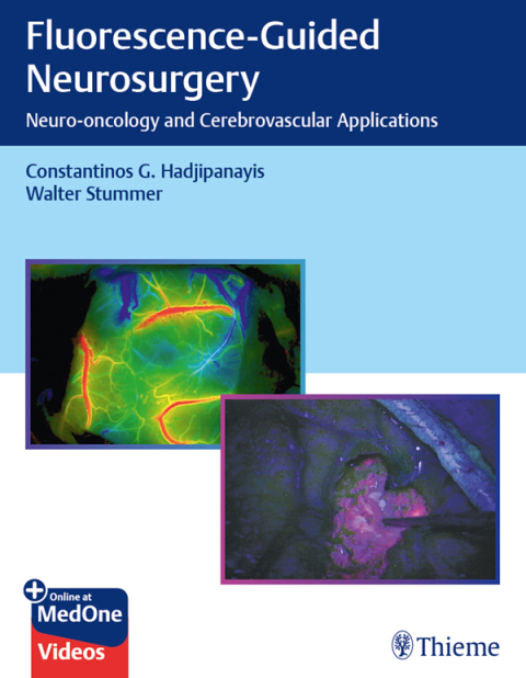Cover image for book Fluorescence-Guided Neurosurgery