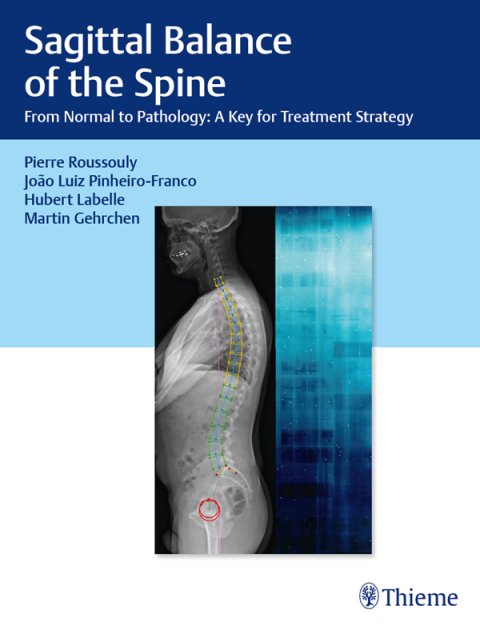 Cover image for book Sagittal Balance of the Spine
