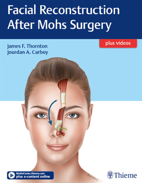 Facial Reconstruction After Mohs Surgery 