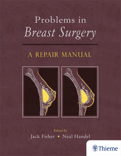 Cover image for book Problems in Breast Surgery