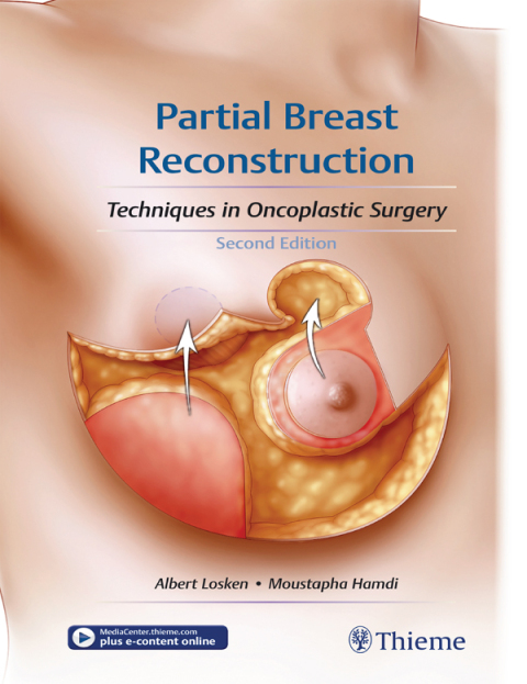 Cover image for book Partial Breast Reconstruction