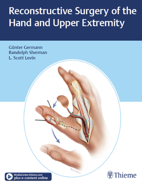 Cover image for book Reconstructive Surgery of the Hand and Upper Extremity