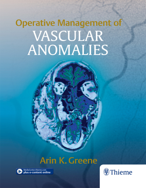 Cover image for book Operative Management of Vascular Anomalies