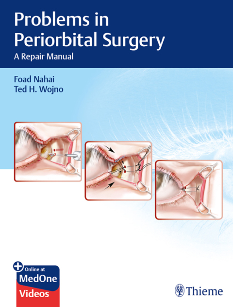 Cover image for book Problems in Periorbital Surgery