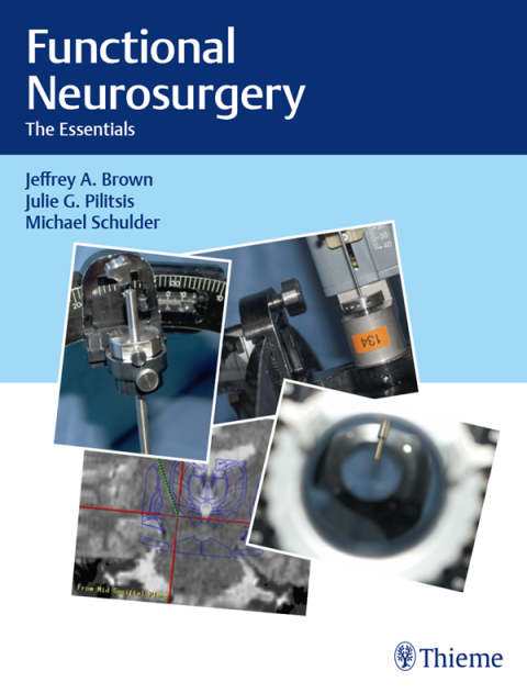 Cover image for book Functional Neurosurgery