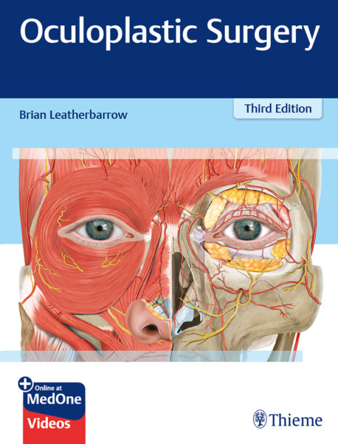 Cover image for book Oculoplastic Surgery