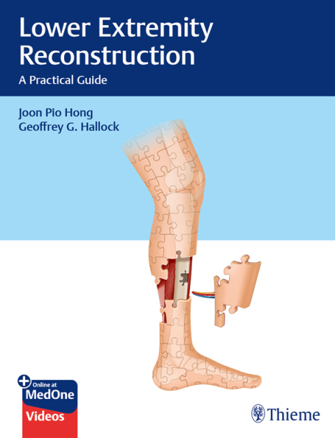 Cover image for book Lower Extremity Reconstruction