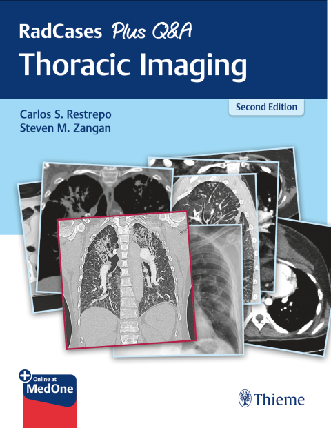 RadCases Plus Q\u0026A Thoracic Imaging 