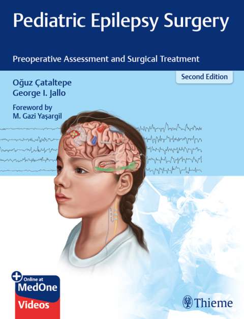 Cover image for book Pediatric Epilepsy Surgery