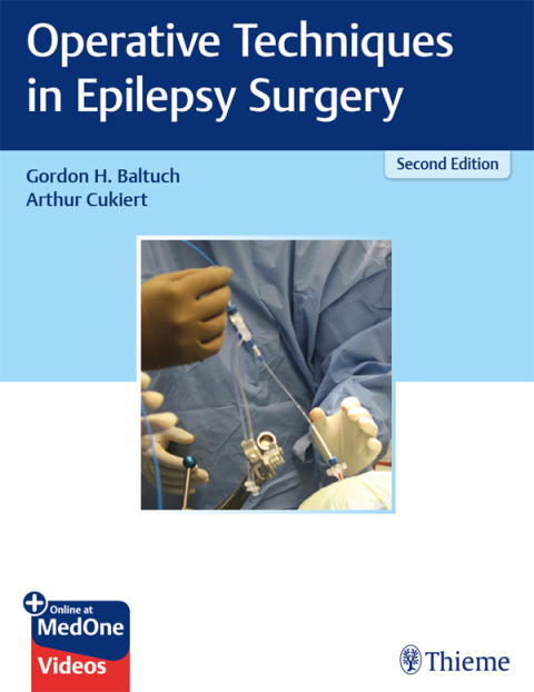 Cover image for book Operative Techniques in Epilepsy Surgery