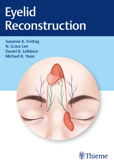Cover image for book Eyelid Reconstruction