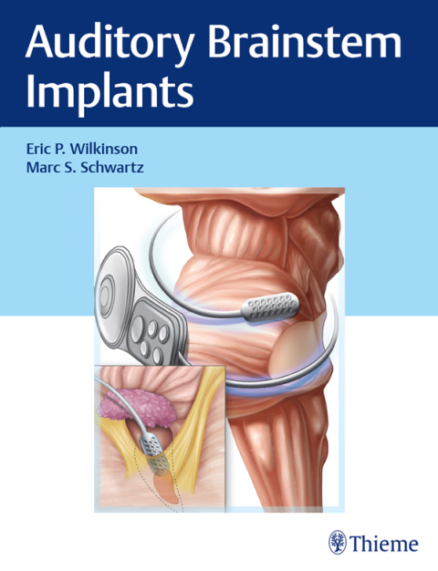 Cover image for book Auditory Brainstem Implants