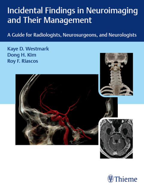 Incidental Findings in Neuroimaging and Their Management 