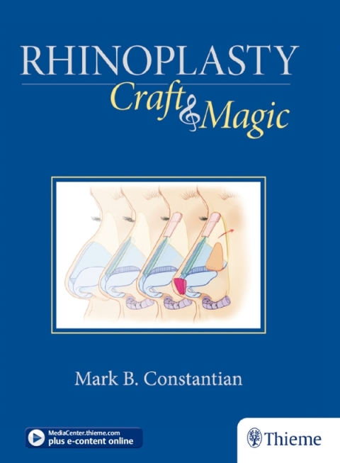Cover image for book Rhinoplasty