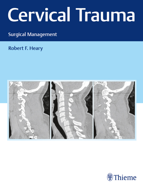 Cover image for book Cervical Trauma