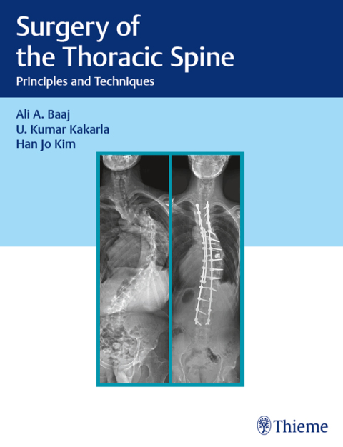 Surgery of the Thoracic Spine 