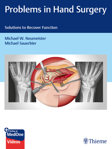Cover image for book Problems in Hand Surgery