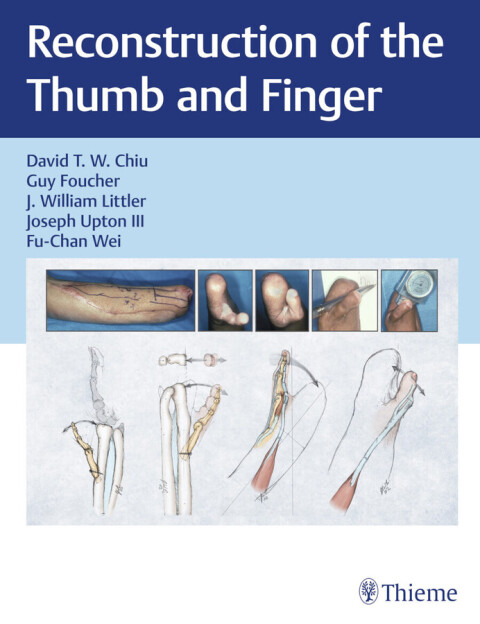 Reconstruction of the Thumb and Finger 