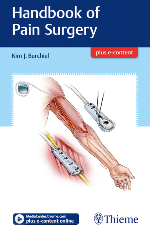 Cover image for book Handbook of Pain Surgery