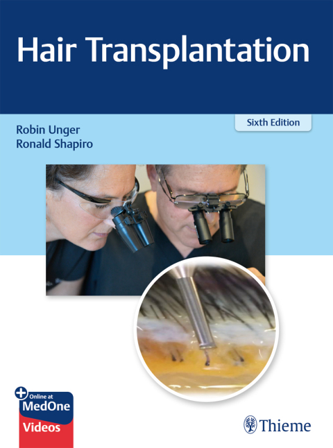 Cover image for book Hair Transplantation