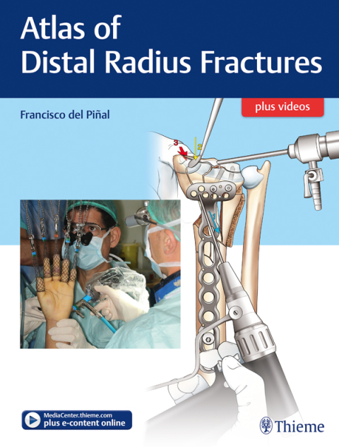 Cover image for book Atlas of Distal Radius Fractures