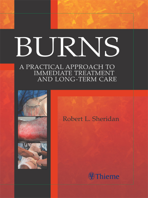 Cover image for book Burns